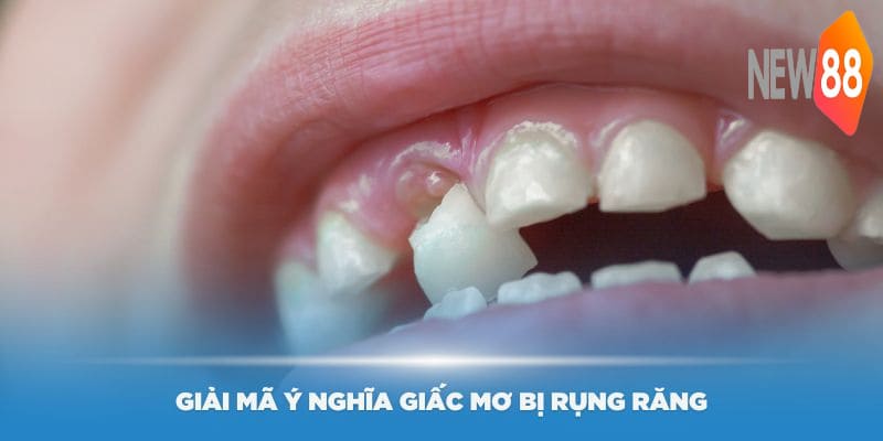 New88 giải mã ý nghĩa giấc mơ bị rụng răng